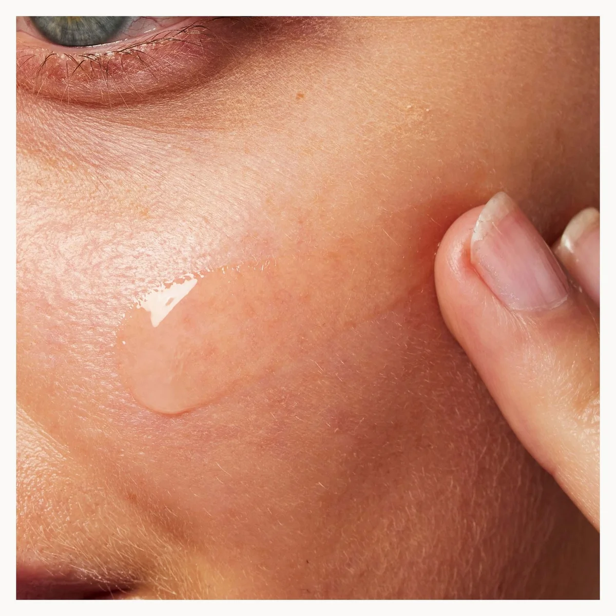 Close-up of a person's cheek with a translucent, glossy gel patch applied, while a finger gently touches the skin.