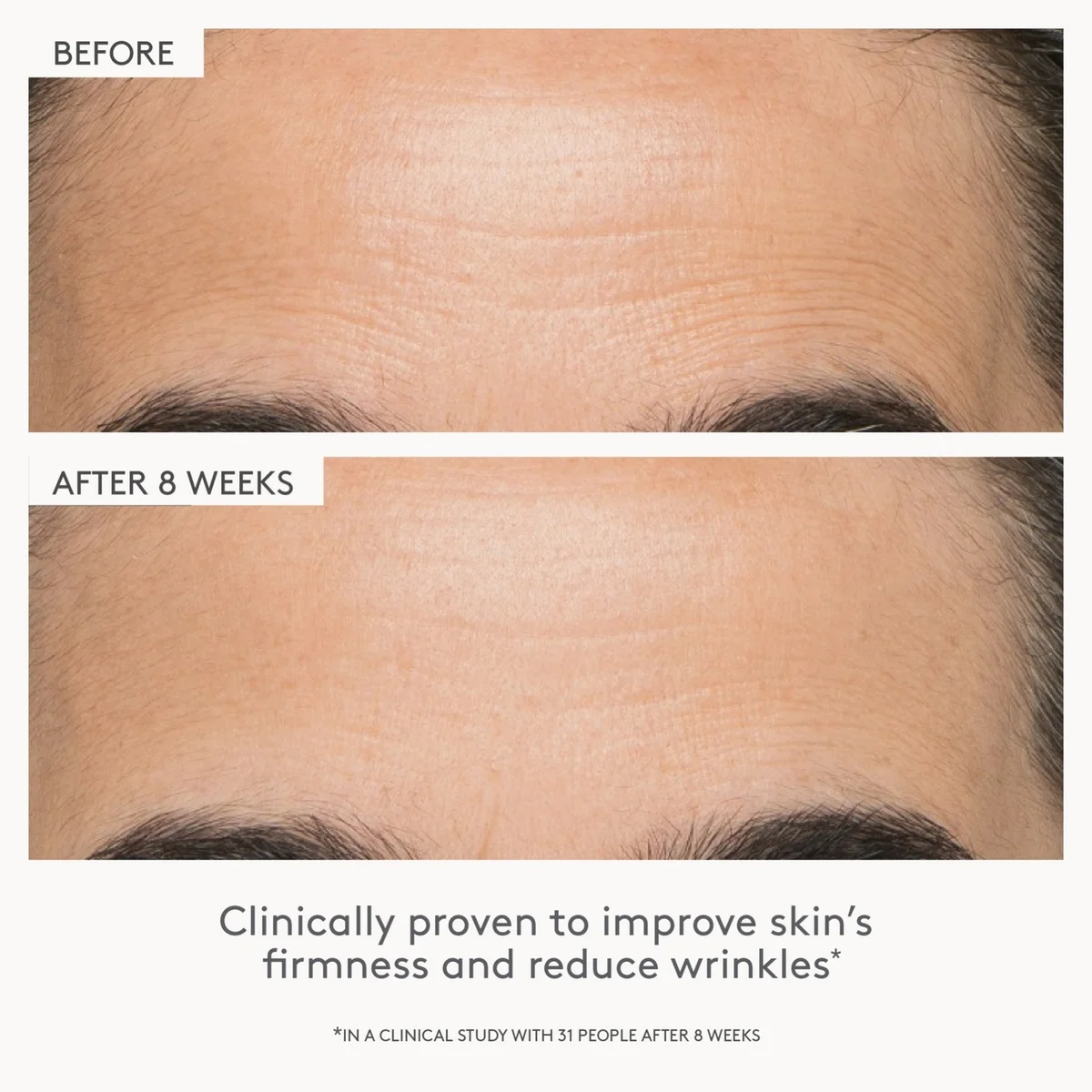 Before-and-after skin comparison showing forehead wrinkles around the eyebrows, with text reading 'BEFORE', 'AFTER 8 WEEKS', and 'Clinically proven to improve skin's firmness and reduce wrinkles'.