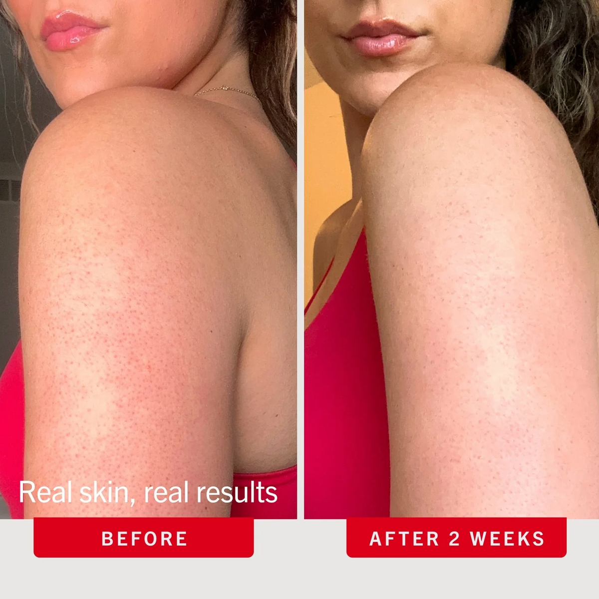 Before-and-after comparison of a woman's upper arm and shoulder showing skin texture improvement, with text reading 'Real skin, real results' and 'BEFORE' / 'AFTER 2 WEEKS'.