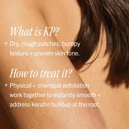 A close-up of a person's shoulder and upper back with overlaid text explaining what KP is and how to treat it, set against a plain light background.