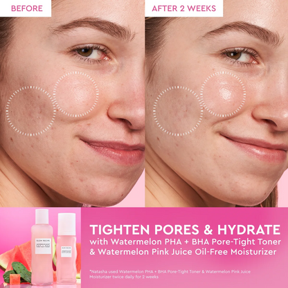 Before and after comparison of skin treatment with product packaging displayed.