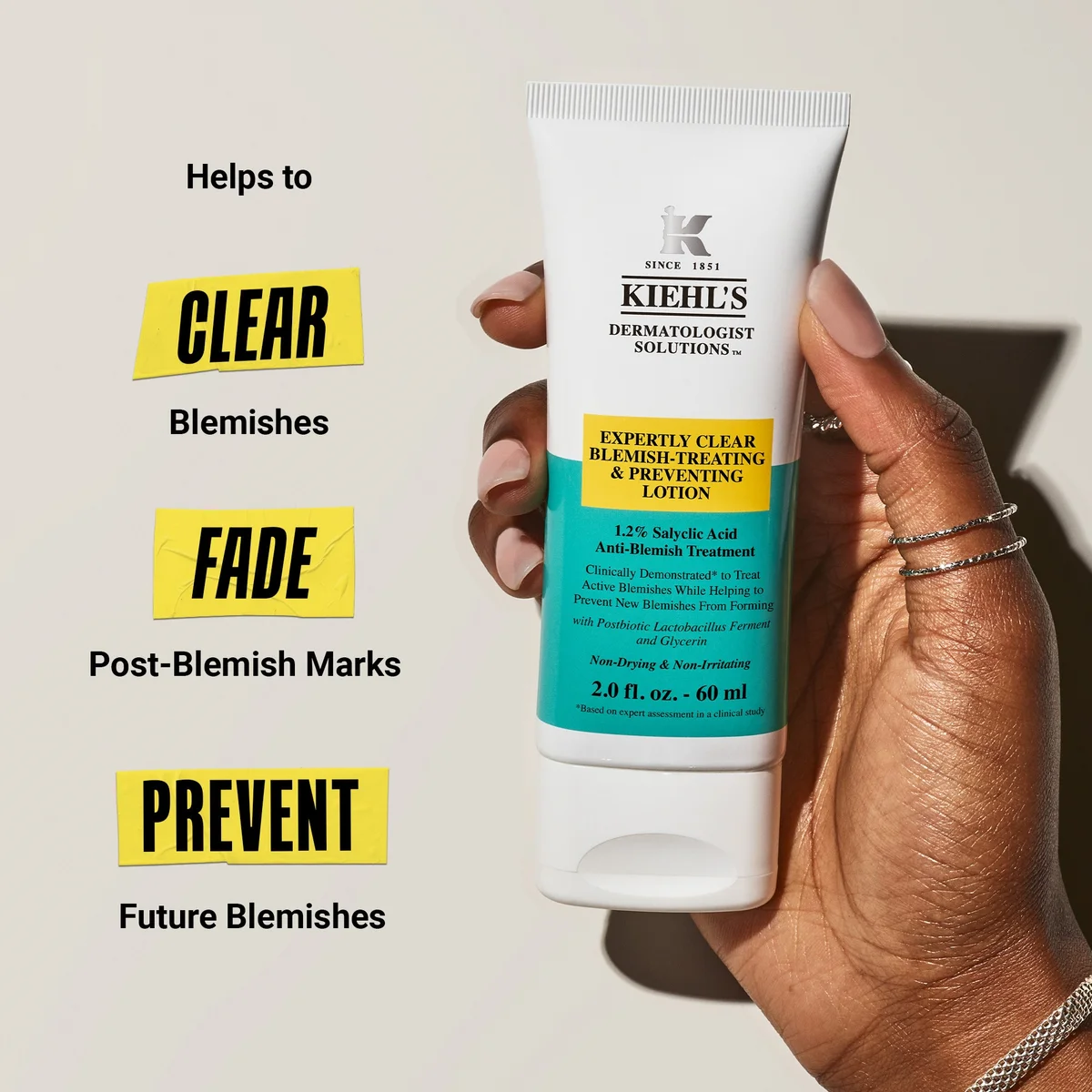 A hand holds a tube of Kiehl's Dermatologist Solutions Expertly Clear Blemishing & Preventing Lotion against a warm beige background with promotional text on the left.