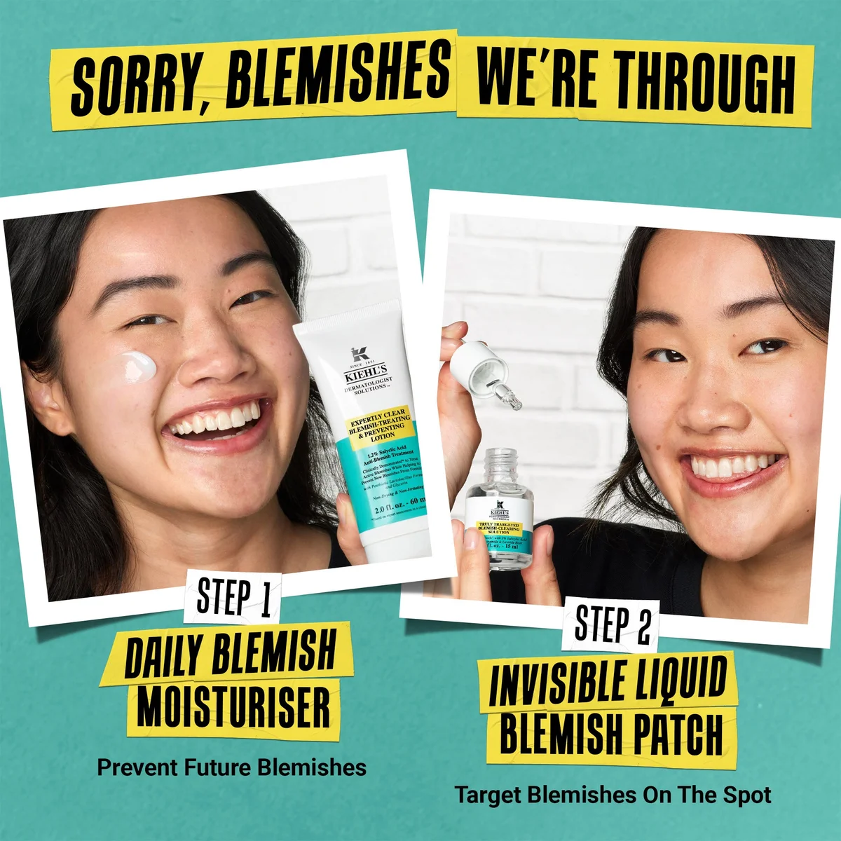 A promotional graphic with two photos of a woman demonstrating skincare steps on a teal background. The top text reads 'SORRY, BLEMISHES WE'RE THROUGH.