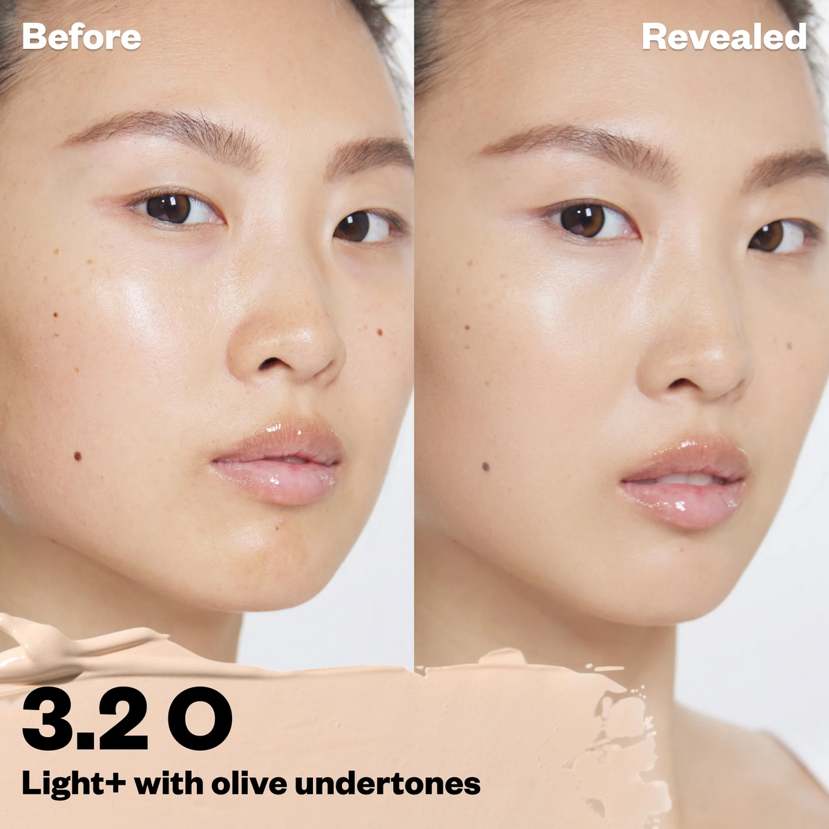 Before and after comparison of a skin treatment with a neutral background