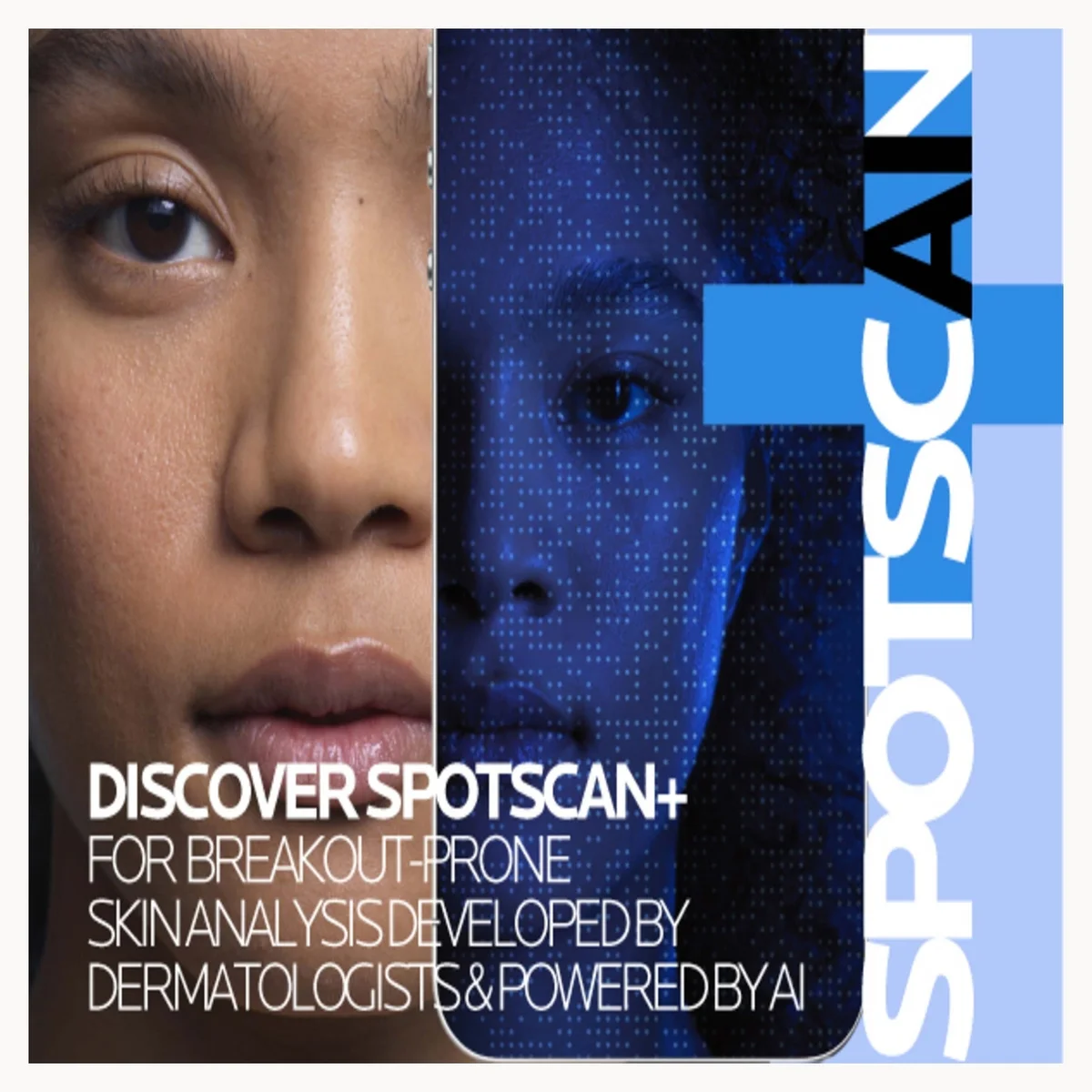 A promotional graphic for Spotscan+ featuring a split-face portrait in warm and cool blue tones, with text reading 'DISCOVER SPOTSCAN+ FOR BREAKOUT-PRONE SKIN ANALYSIS DEVELOPED BY DERMATOLOGISTS & POWERED BY AI' and a large vertical SPOTSCAN logo on a light blue background.