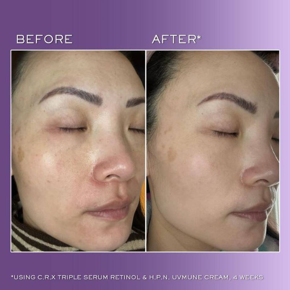 Lancôme Rénergie C.R.x. Triple Serum Retinol 50ml Anti-Ageing