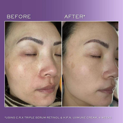 Lancôme Rénergie C.R.x. Triple Serum Retinol 50ml Anti-Ageing