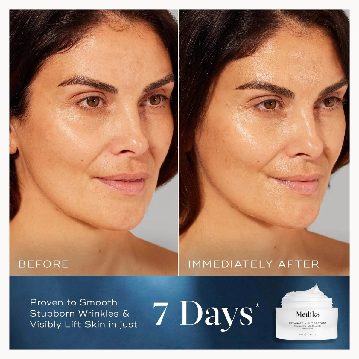 Before and after comparison of a woman's face with skincare product packaging.