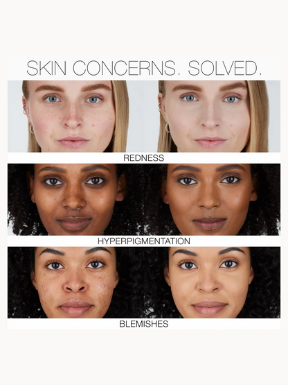A before-and-after comparison graphic showing three skin concerns: redness, hyperpigmentation, and blemishes. The top row shows a lighter, clearer complexion labeled 'REDNESS,' the middle row shows darker hyperpigmented skin labeled 'HYPERPIGMENTATION,' and the bottom row shows clearer skin labeled 'BLEMISHES.