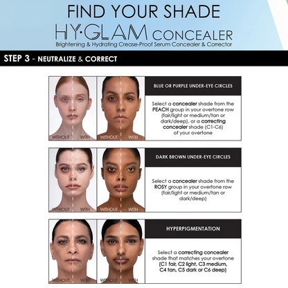 A shade guide infographic for Hy-Glam Concealer, titled 'FIND YOUR SHADE'. The graphic features three rows of before-and-after face photos demonstrating skin tone correction for blue/purple under-eye circles, dark brown under-eye circles, and hyperpigmentation.