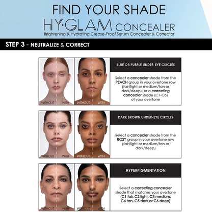 A shade guide infographic for Hy-Glam Concealer, titled 'FIND YOUR SHADE'. The graphic features three rows of before-and-after face photos demonstrating correction of blue/purple under-eye circles, dark brown under-eye circles, and hyperpigmentation.