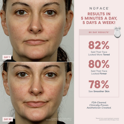 Before and after effects of a facial treatment with Nuface device on a woman's face, showing improved skin tone, firmness, and smoothness.