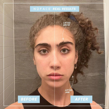 Before and after comparison of a woman's face with text indicating 'No Face Real Results' and 'Lifted Brow'.