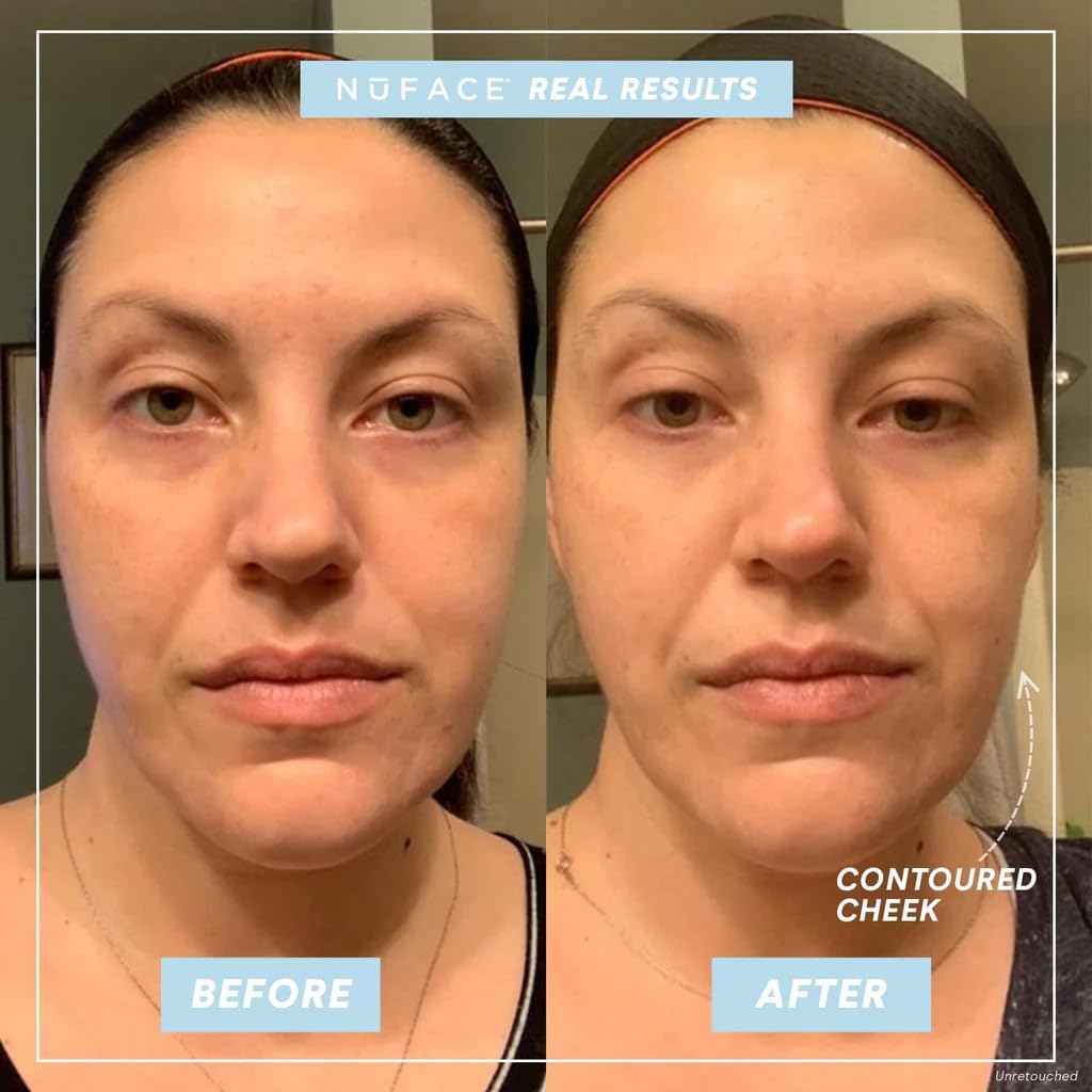 Before and after comparison of a woman's face with 'Contoured Cheek' label