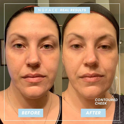 Before and after comparison of a woman's face with 'Contoured Cheek' label