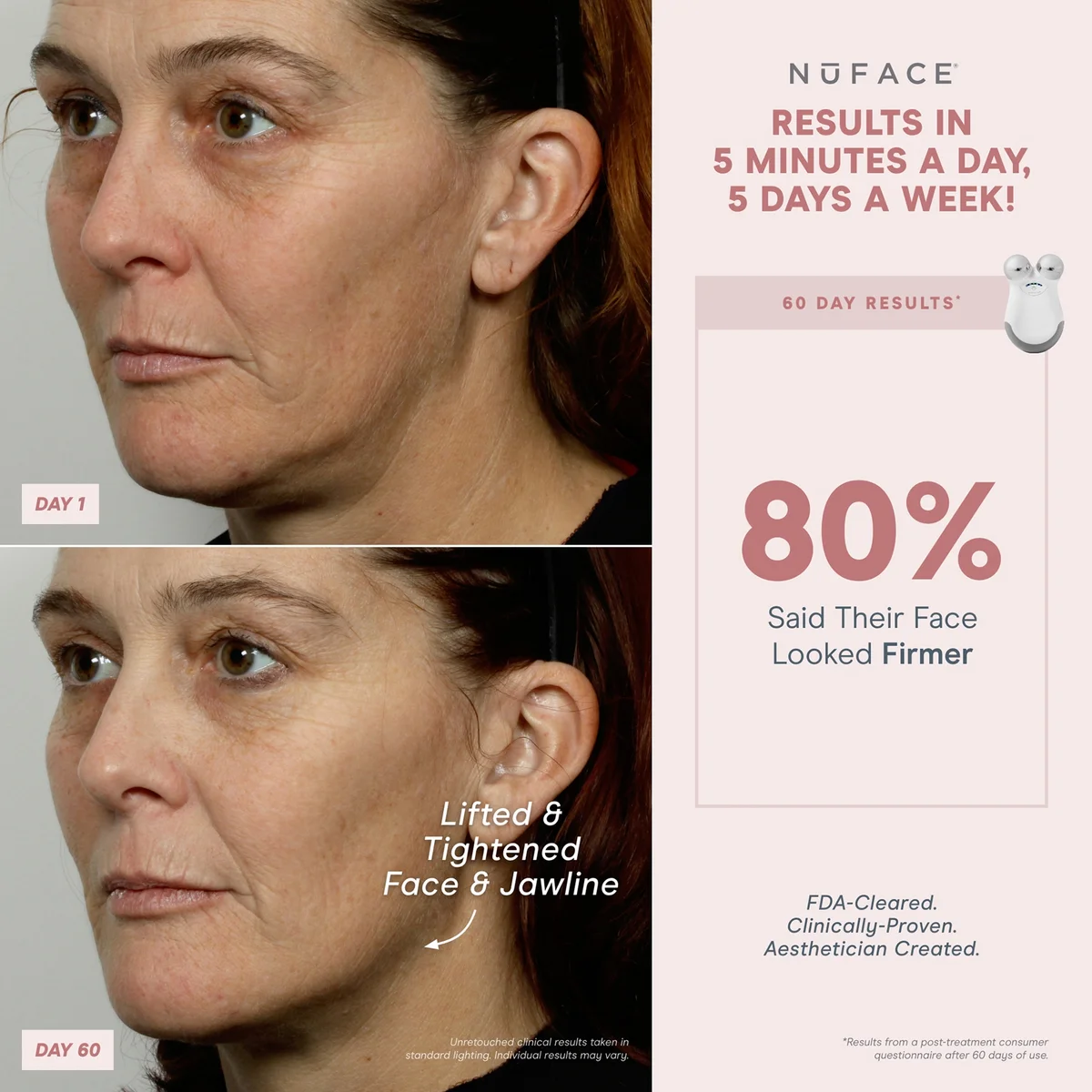 Before and after comparison of a woman's face with Nuface device results, showing lifted and tightened jawline.