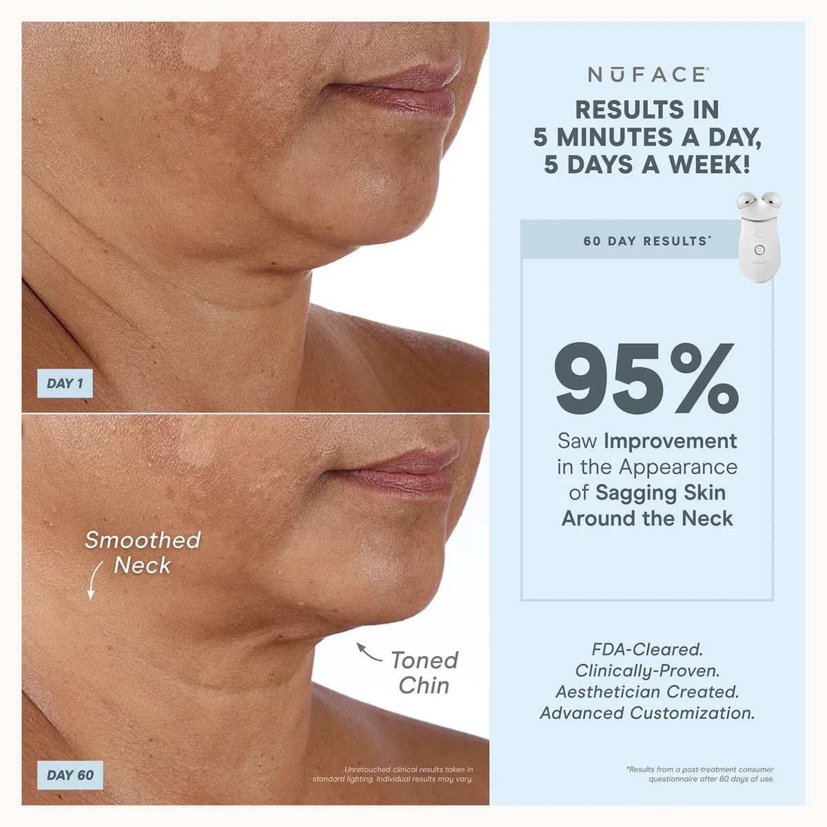 NuFACE TRINITY+ Effective Lip & Eye Attachment