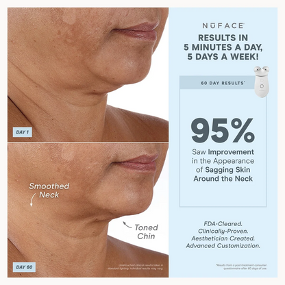 NuFACE TRINITY+ Effective Lip & Eye Attachment