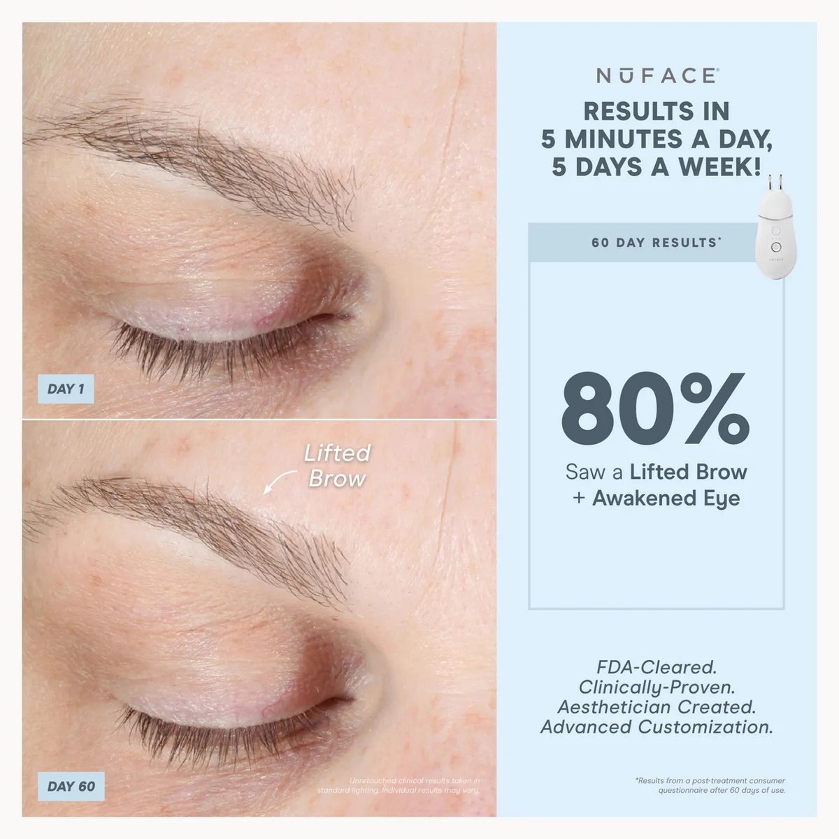 NuFACE TRINITY+ Effective Lip & Eye Attachment