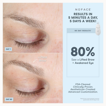 NuFACE TRINITY+ Effective Lip & Eye Attachment
