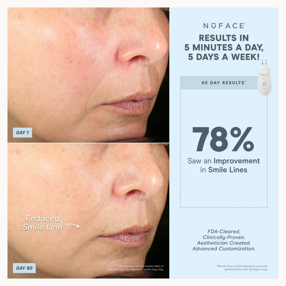 NuFACE TRINITY+ Effective Lip & Eye Attachment