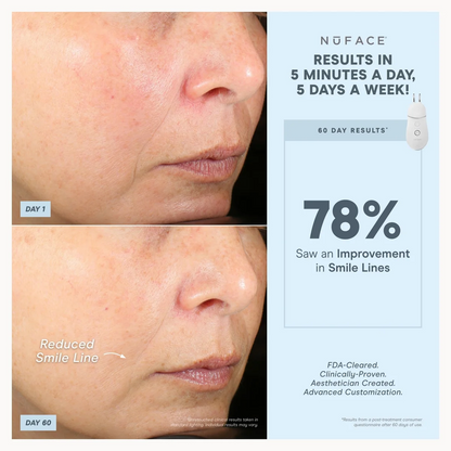 NuFACE TRINITY+ Effective Lip & Eye Attachment
