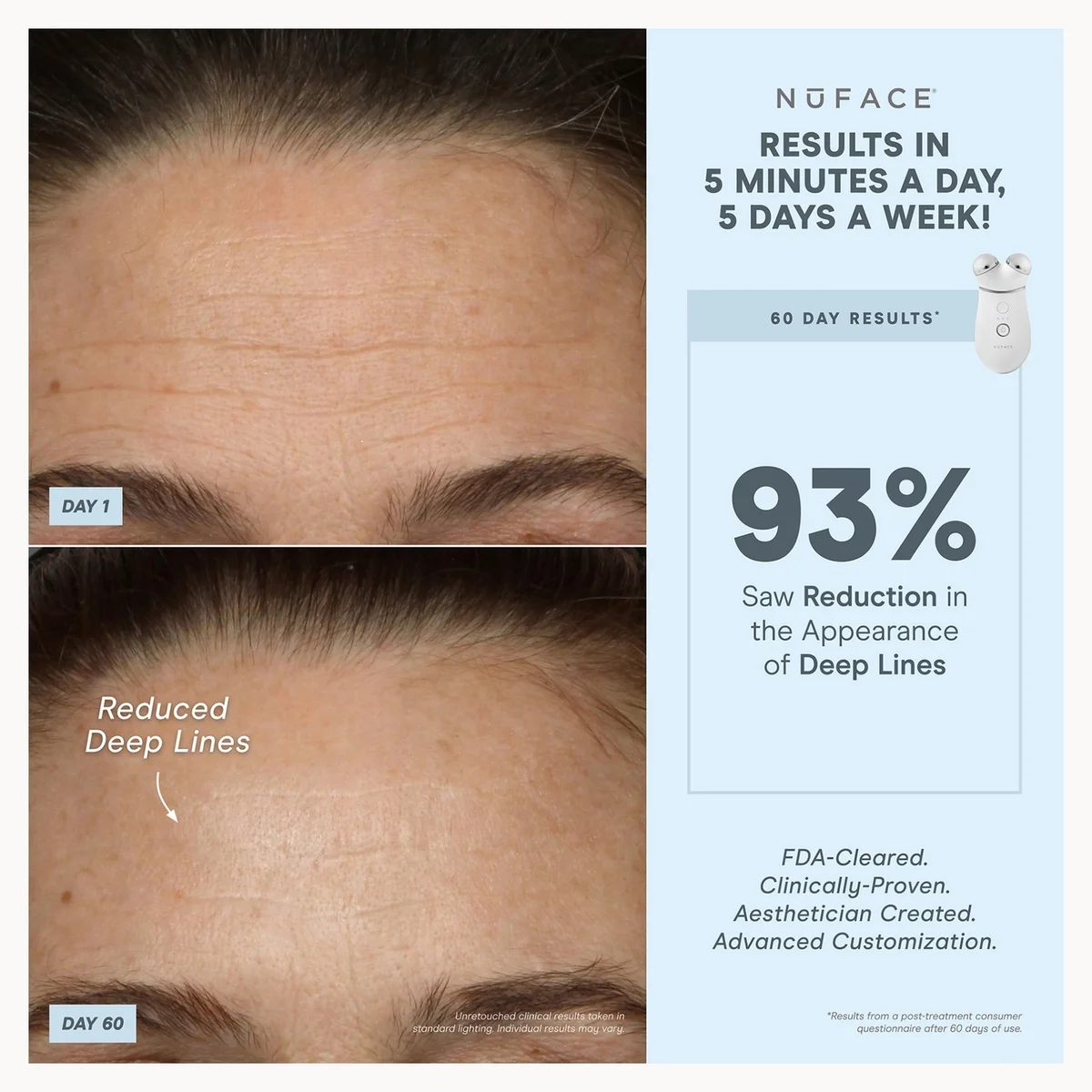 NuFACE TRINITY+ Effective Lip & Eye Attachment