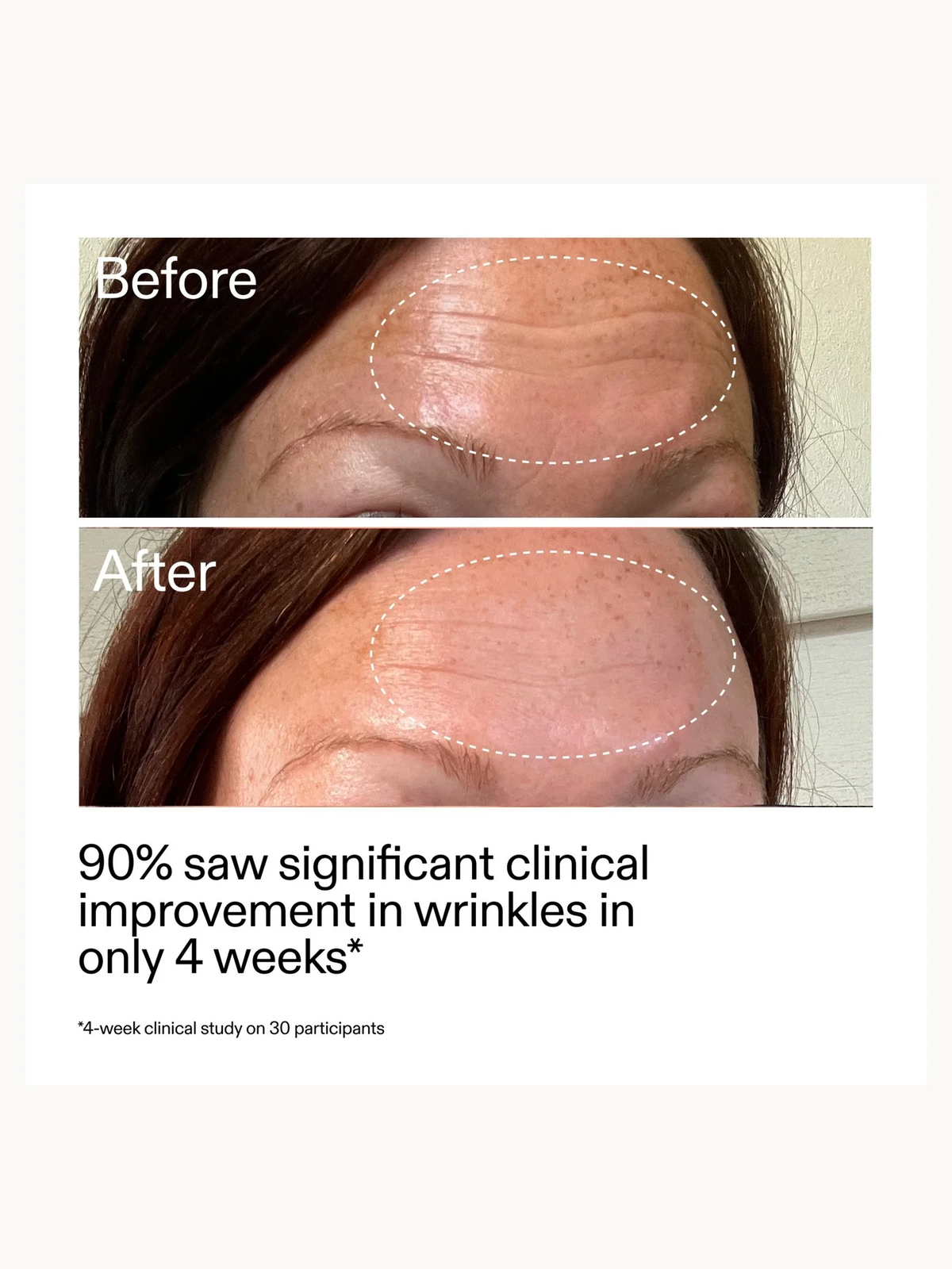 The INKEY List Retinol Serum 30ml (Broken Box)