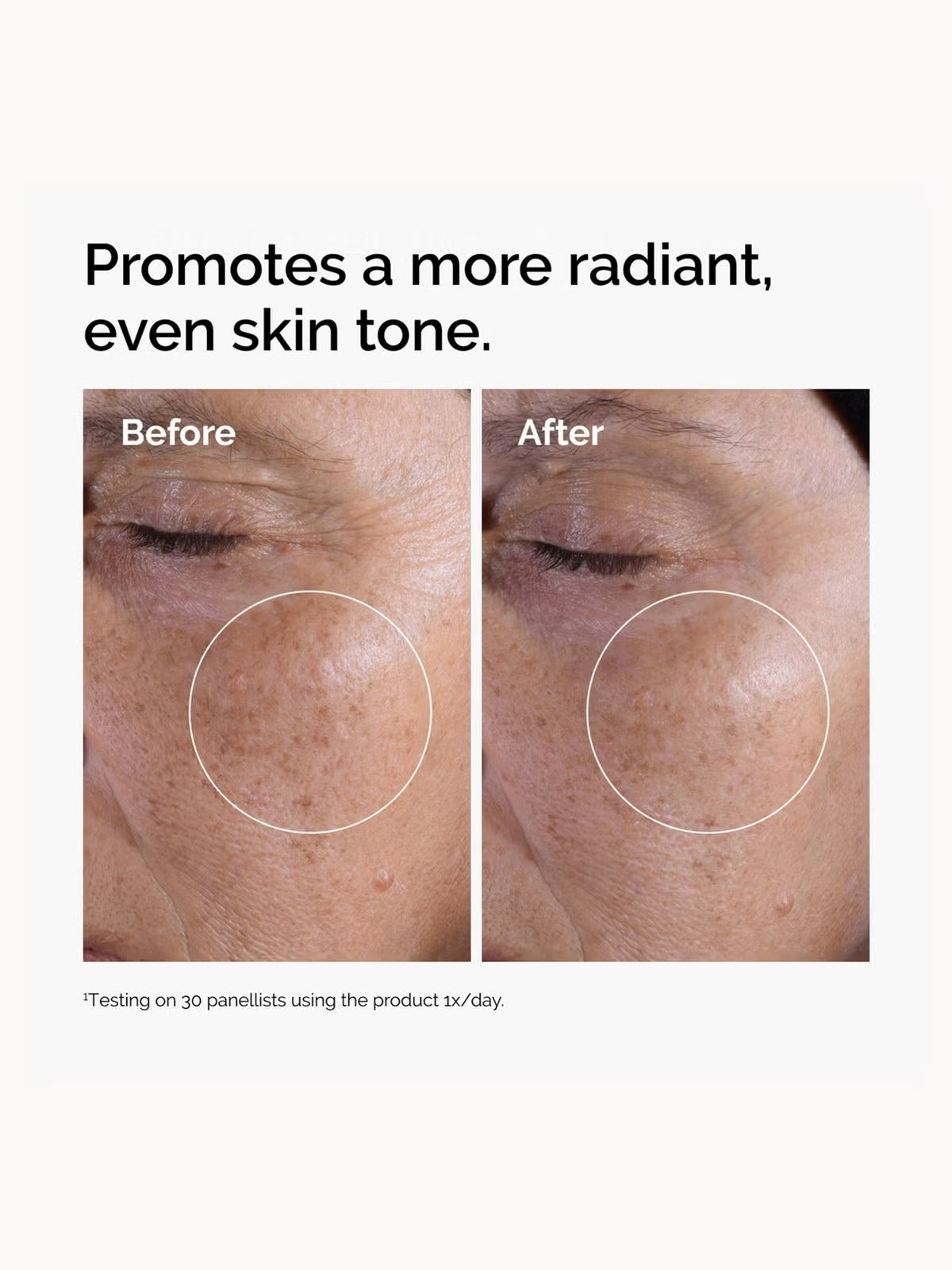 Before and after comparison of skin with a focus on a dark spot, promoting a more radiant, even skin tone.