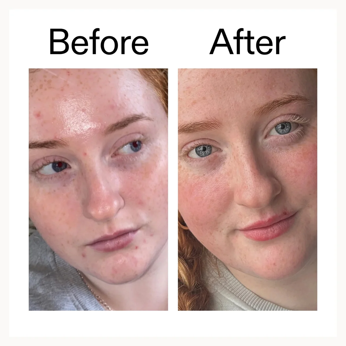 Before and after comparison of a person's face with visible improvements.